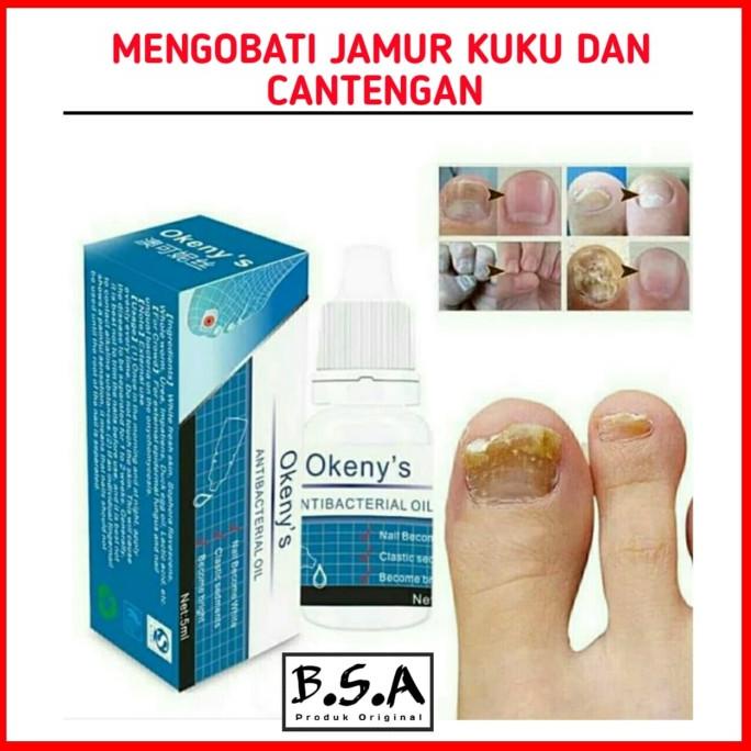 

Discount HERBAL OBAT CANTENGAN & KUKU JAMURAN atau RUSAK /OBAT HERBAL ASAM URAT/OBAT HERBAL PELANGSING/OBAT HERBAL KOLESTEROL/OBAT HERBAL DIABETES