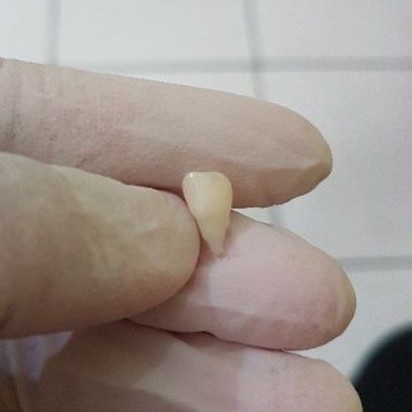 [SULUNG/SUSU] GIGI ASLI MANUSIA SERI / INCISIVUS SUSU / SULUNG / ANAK UNTUK PRAKTIKUM