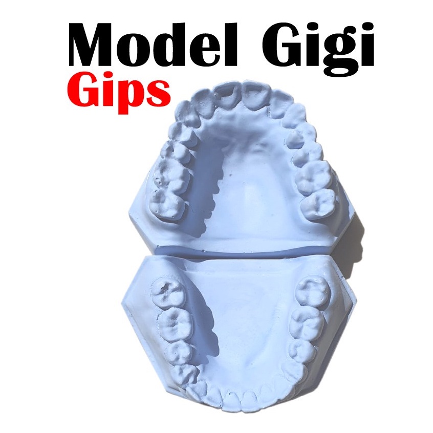 patung gigi gips / model gigi
