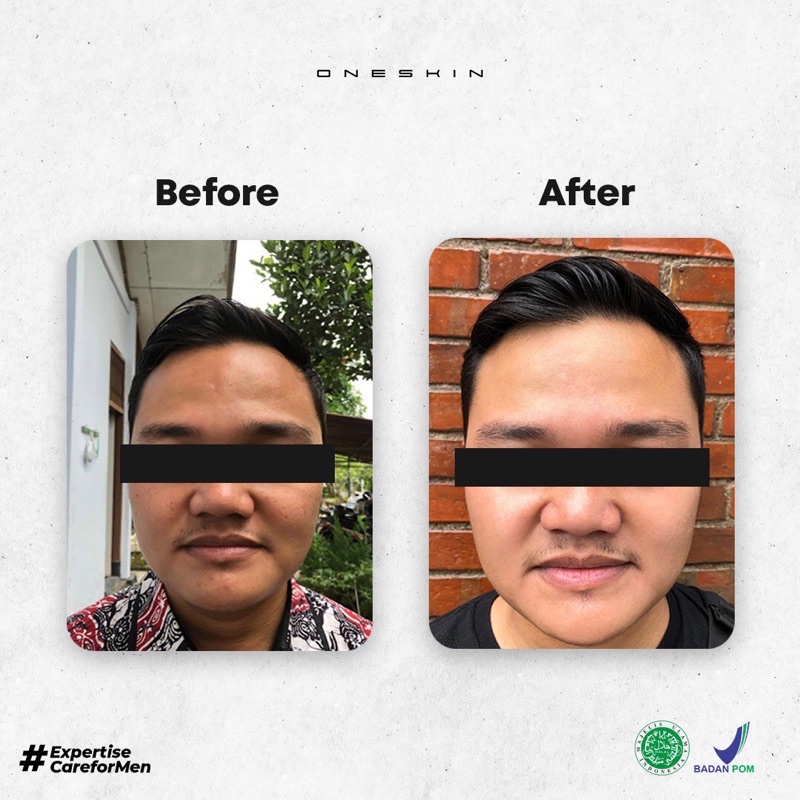 ONESKIN Paket Advance | Paket Pencerah Wajah Pria - Paket Lengkap-6