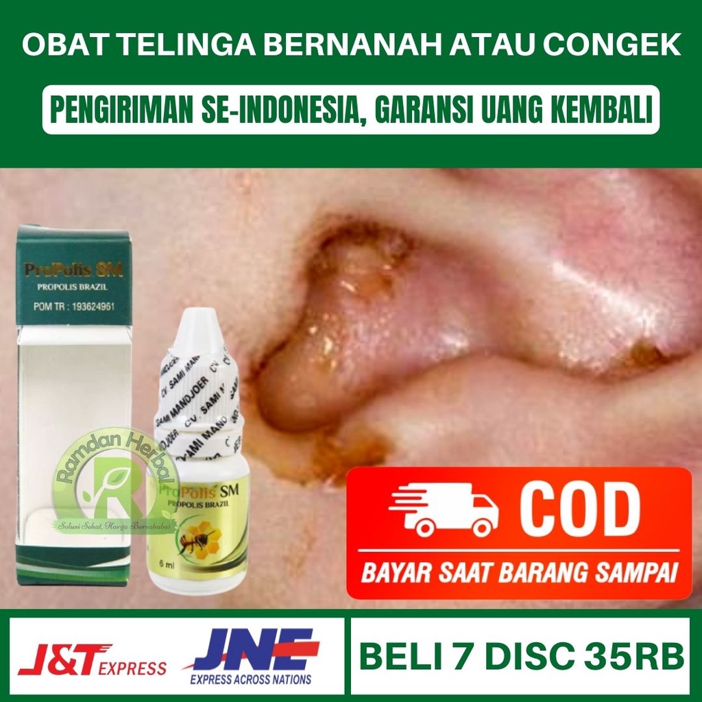 Obat Telinga Bernanah Atau Congek Berbau Congek Menahun Telinga Berair Propolis SM