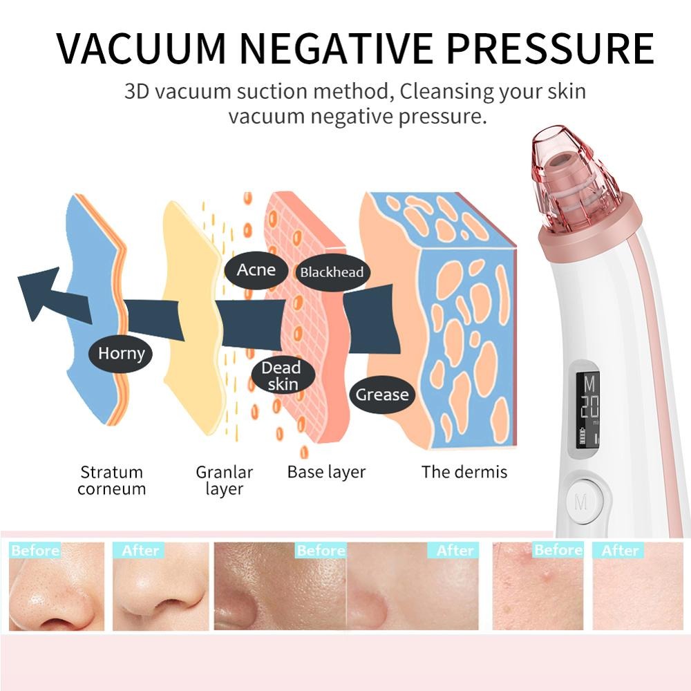 Penghisap Komedo Vacuum Suction Skin Face Care Blackhead Pore Cleaner - ALHTY06-02