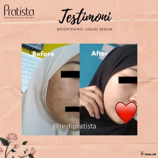 Pratista Brightening Liquid Serum Untuk Flek Kemerahan &amp; Bekas Jerawat