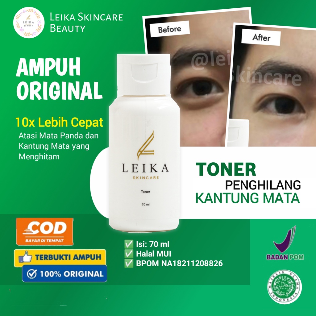 AMPUH Obat Kantung Mata Ampuh Penghilang Kantung Mata Permanen BPOM Menghilangkan Kantung Mata Hitam