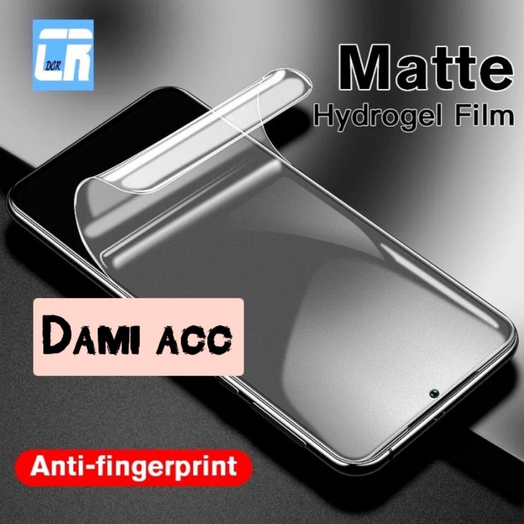 hydrogel andromax a antishock hydrogel tg screen protector