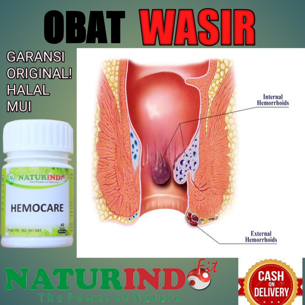 Obat Wasir Ambeien Stadium 1 Sampai 4 Paling Ampuh Herbal Shopee Indonesia