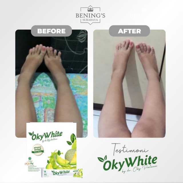 BENING'S OKYWHITE | MEMUTIHKAN &amp; MENCERAHKAN KULIT | BPOM &amp; HALAL | FREE GIFT SIAP KIRIM SELURUH INDONESIA