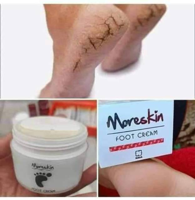 Moriskin Foot Crem Nasa