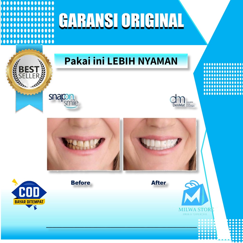 Gigi palsu murah snap on smile lebih lembut dan nyaman original import