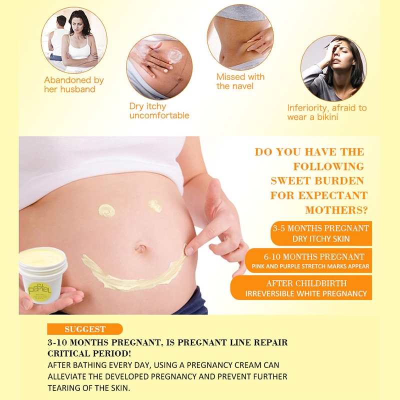 Krim stretch mark Mengencangkan meudarkan garis pasca persalinan/Menghilangkan stretch mark Menghilangkan garis penumbuhan/Perbaikan stretch mark Menghilangkan garis penumbuhan/Khusus pengguna ibu hamil Perbaikan stretch mark