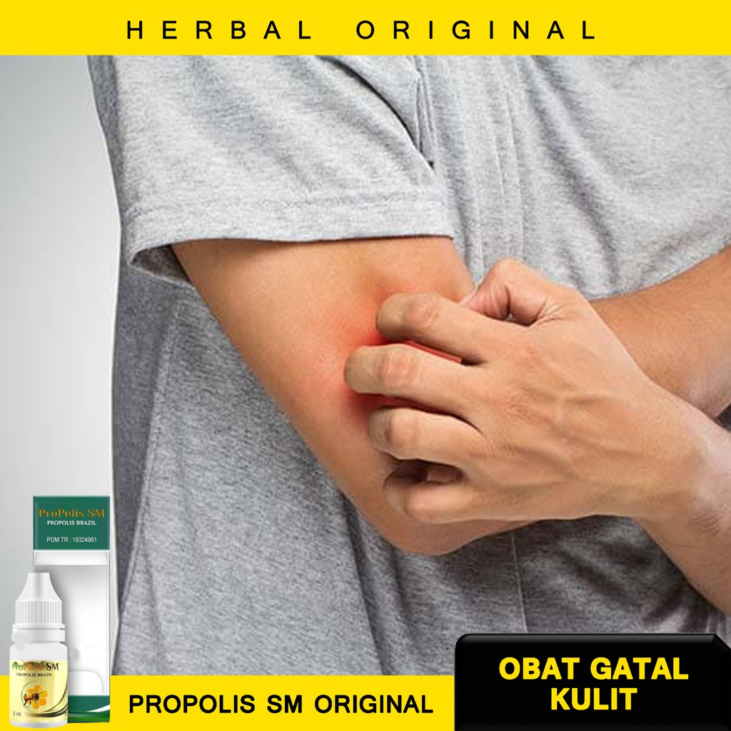 Obat Menghilangkan Gatal - Obat Gatal Kulit - Obat Gatal Gatal Di Seluruh Badan - Obat Gatal Menahun