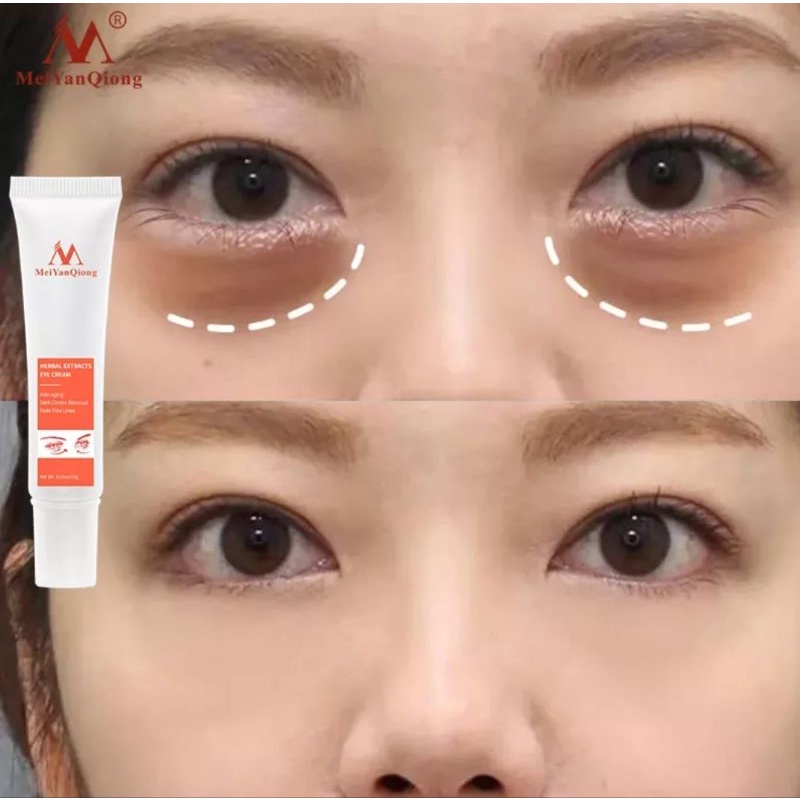 MeiYanQiong Herbal Probiotic Eye Cream Mengurangi Dark Circle-Anti Wrinkle-Anti Aging-Mengurangi Lingkaran Mata Hitam-15gr