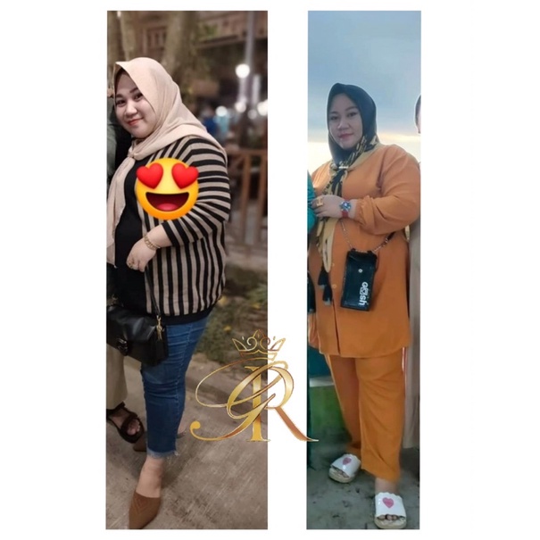 pelangsing colagen 9R galery rayyan