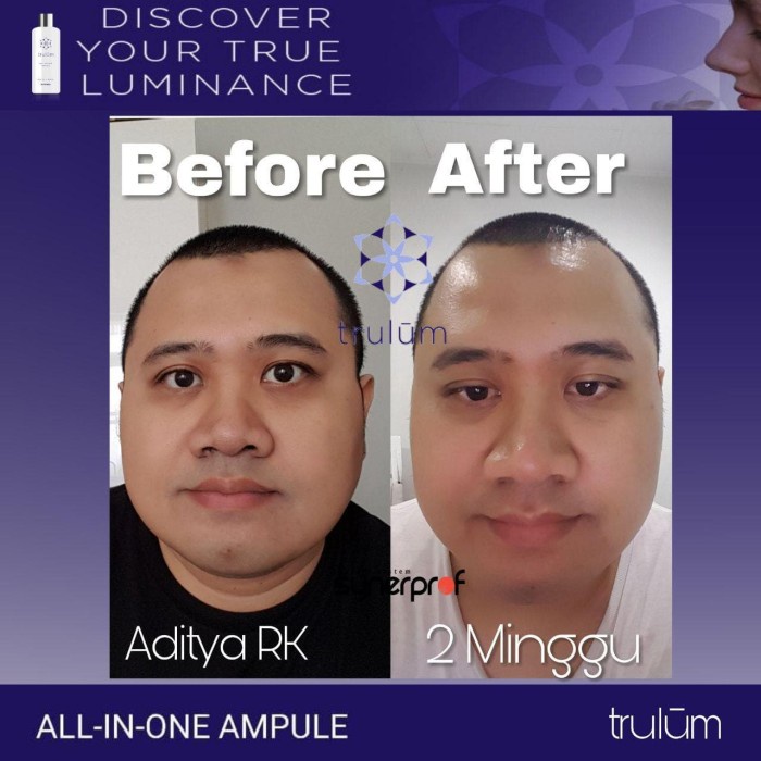 serum wajah pria | krim flek hitam - cream penghilang flek hitam ampuh - trulum 5 ml safa