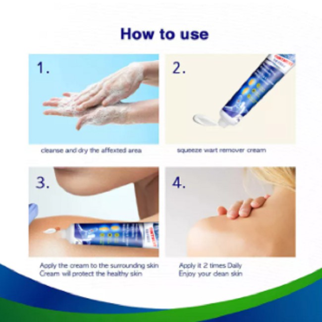 Skin Tag Remover Menghilangkan Kutil Tahi Lalat Mata Ikan Wart-4