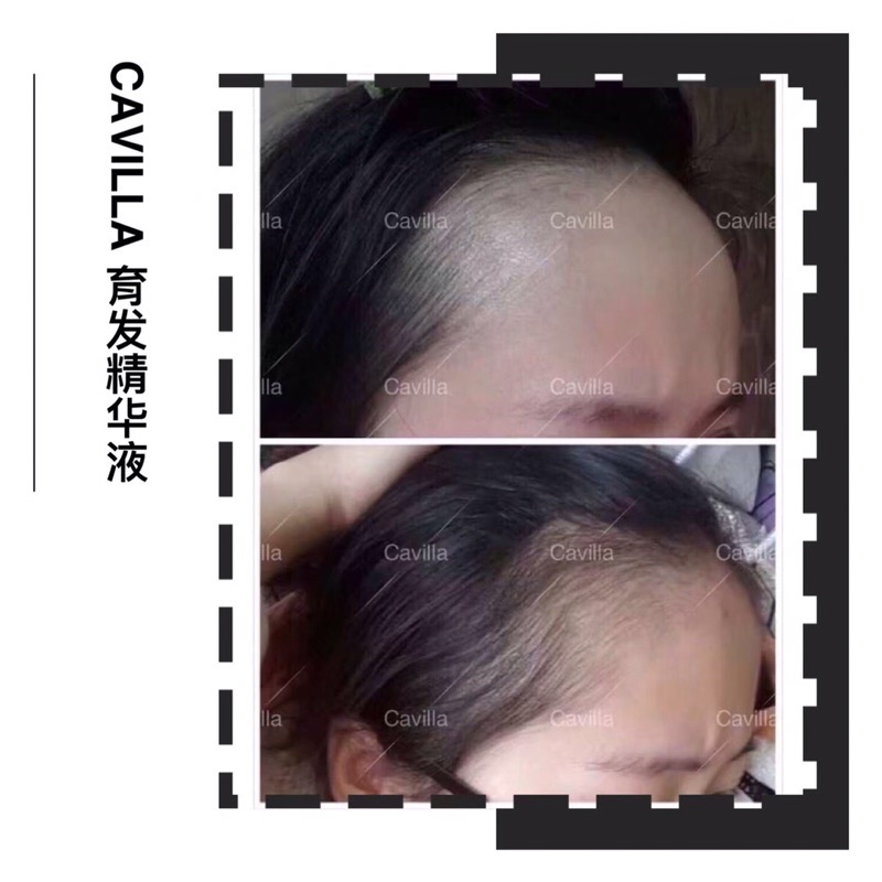 CAVILLA HAIR TONIC PENUMBUH RAMBUT CEPAT ALAMI (100% ORIGINAL)