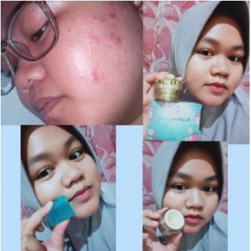 GOLD JELLY KEDAS BEAUTY 100% ORIGINAL (NEW)-1