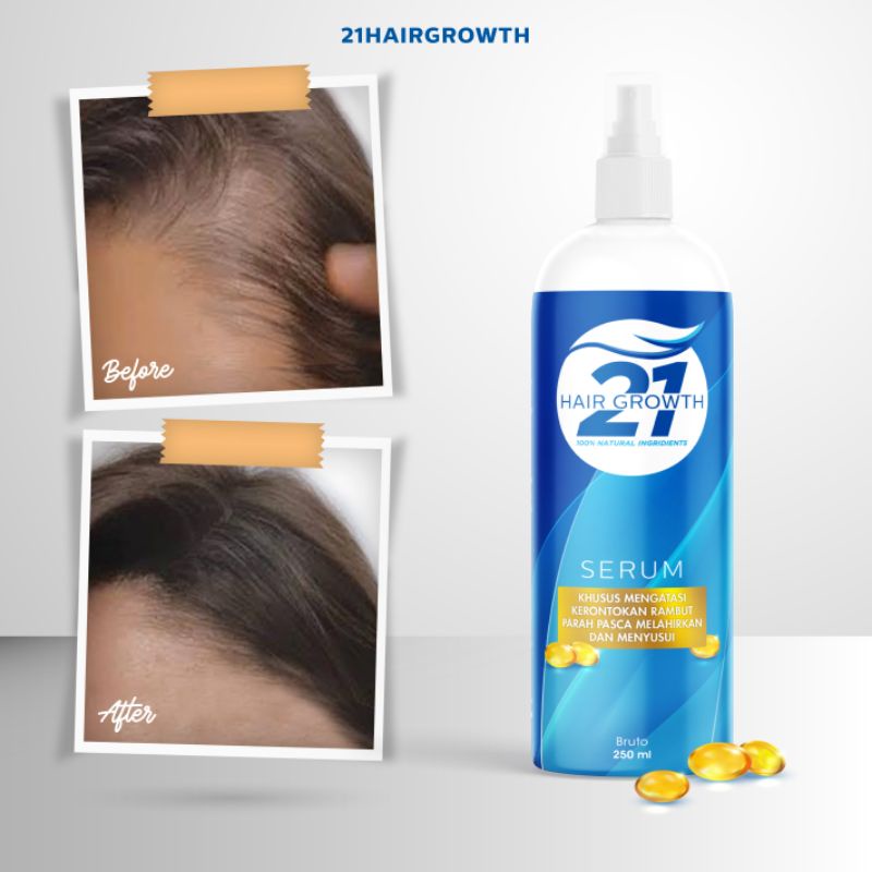 Serum Kerontokan Rambut Parah Pasca Melahirkan &amp; Menyusui, 99% alami - Postpartum