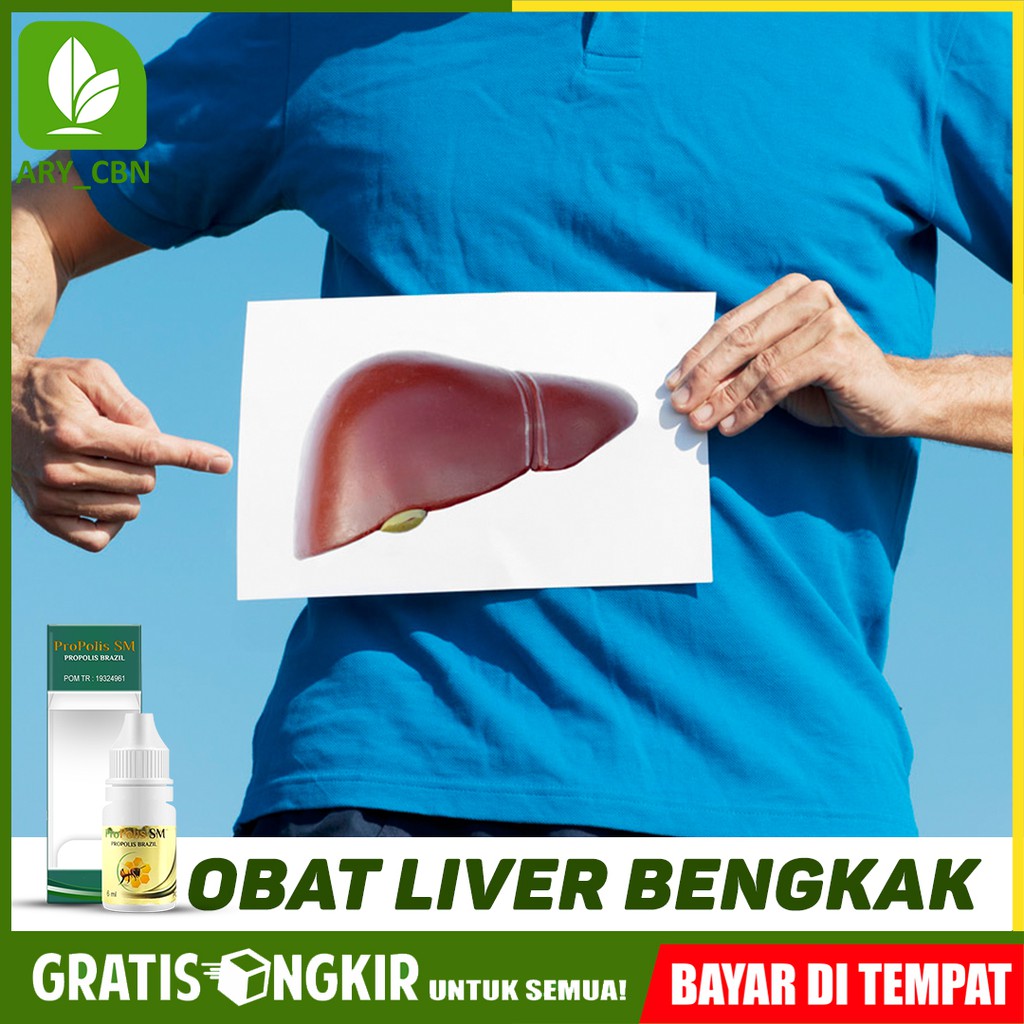 Obat Liver Bengkak, Hati Liver, Hepatitis, A B C Sirosis Herbal PROPOLIS SM Di Cirebon Bisa COD