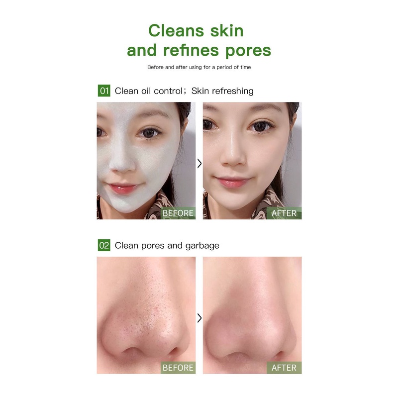 [100% Asli + Real Pict] Green Mask Stick Original Untuk Jerawat Wanita dan Pria Pembersih Komedo Pori - Pori