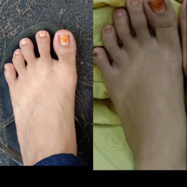 BSC lotion testi dosis normal