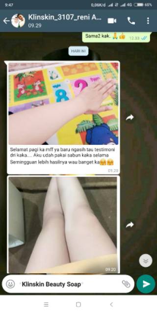 SABUN KLINSKIN PEMUTIH BADAN DAN WAJAH WANITA