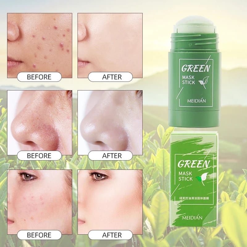 MASKER KOMEDO VIRAL MEIDIAN GREEN STICK MASK MASKER GREEN TEA KOMEDO JERAWAT