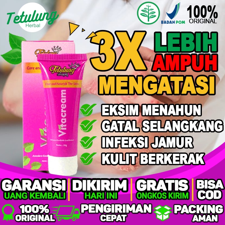 Obat Eksim Kering Di Kaki Obat Salep Eksim Kering Obat gatal selangkangan