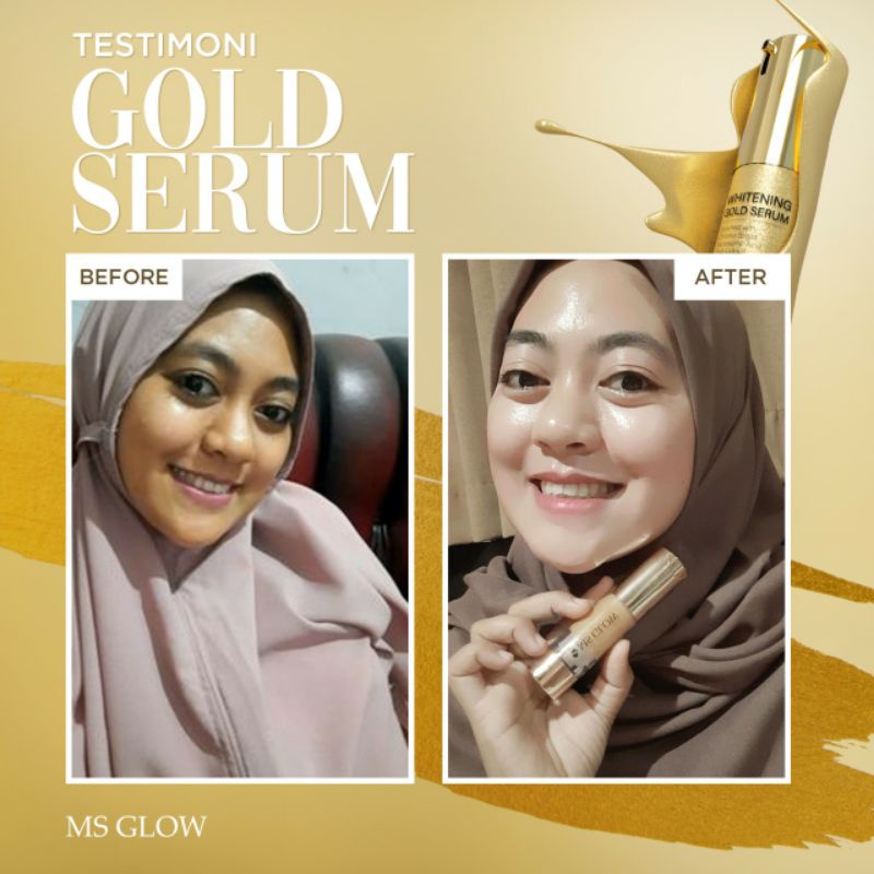 Ms Glow Whitening Gold Serum Ms Glow Original 100% Serum Antiflek Dan Noda Hitam 10X Lipat Mencerahkan Ms Glow