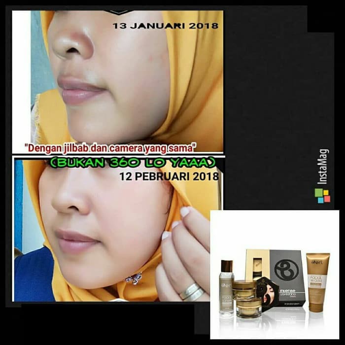 B ERL COSMETICS INTENSE LIGHTENING SERIES PAKET CREAM PERAWATAN WAJAH berlcosmetics kosmetik wajah