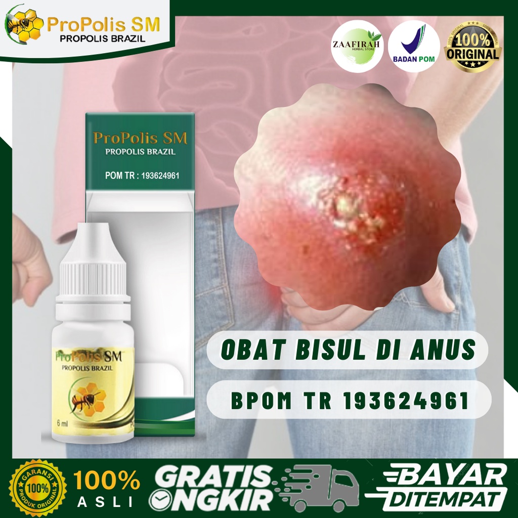 Obat Bisul Di Anus - Abses Anus - Benjolan Bernanah Di Anus - Fistula Ani - Kutil Anus - Koreng Di P