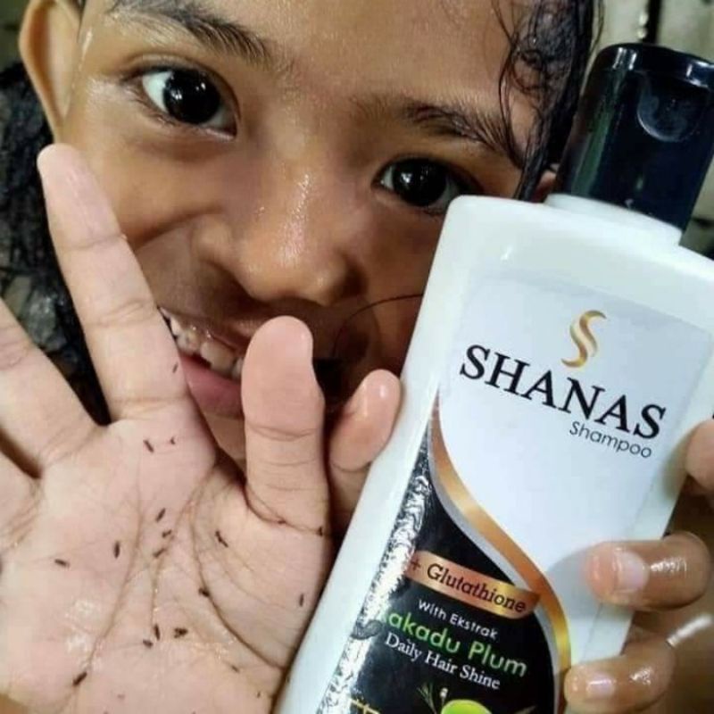 COD free ongkir Shampo kutu rambut - shampo shanas - sampo kutu rambut - sampo sanas