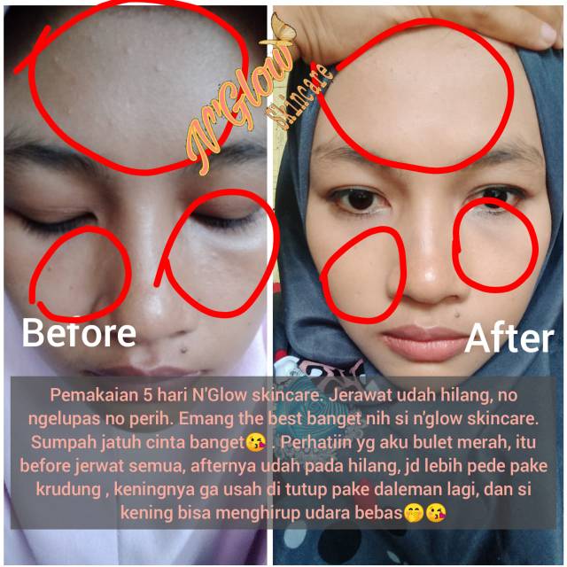 N Glow Skincare Shopee Indonesia