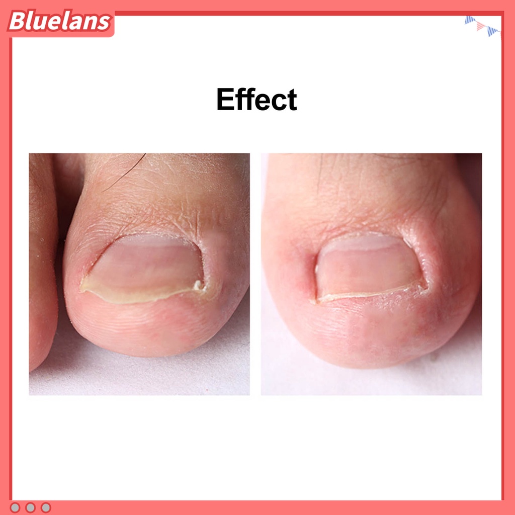 (In Stock) Kacamata Hitam Lensa Warna Warni ♡Gunting Kuku Kaki Kutikula Universal Bahan Stainless Steel Untuk Pedicure