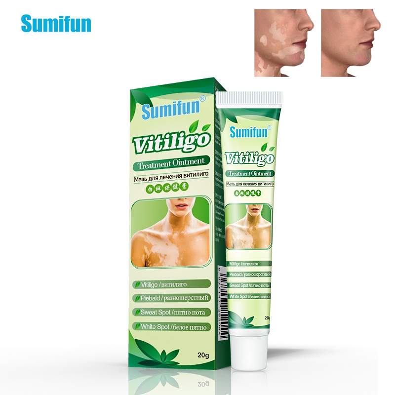 Sumifun Obat Salep Vitiligo Brecak Putih / Kulit Belang Pitih Krim Vitiligo Herbal - 20gr