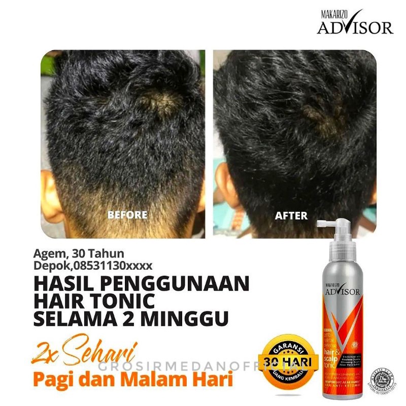 MAKARIZO ANTI HAIR FALL DEFENSE - TONIK ANTI RAMBUT RONTOK DAN KETOMBE - MAKARIZO ADVISOR HAIR AND SCALP TONIC