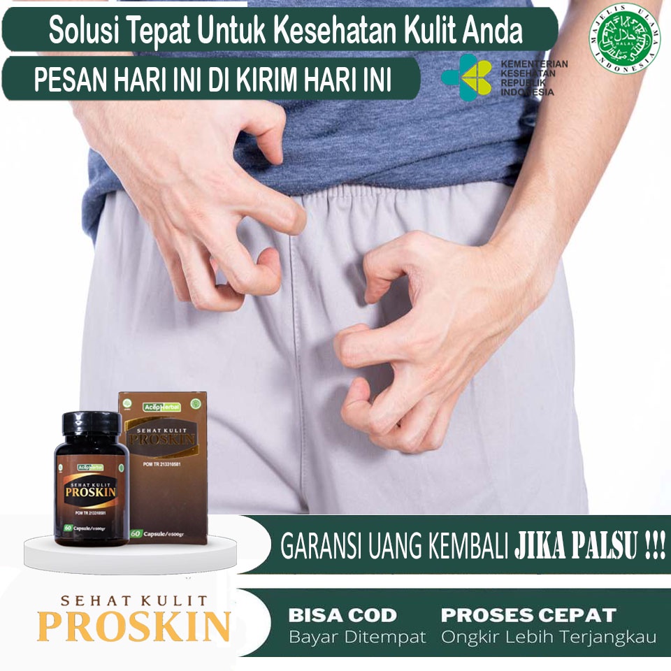Obat Selangkangan Iritasi, Sakit, Perih, Obat Kurap Selangkangan,Obat Selangkangan Lecet, Obat Irita
