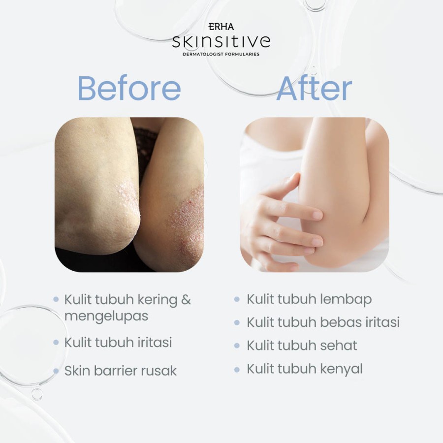 ERHA Body Lotion Skinsitive DF Ultracalm Skin Barrier 125 g