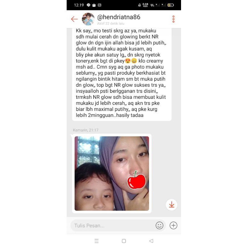 CREAM FLEK NRGLOW RJNSKIN CREAM JERAWAT CREAM KULIT SUSAH PUTIH FLEK TEBAL(AMPUH)