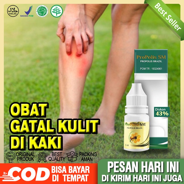 Obat Gatal Kulit Di Kaki, Gatal Kulit Berair, Gatal Bintik Berair Di Tangan Dan Kaki