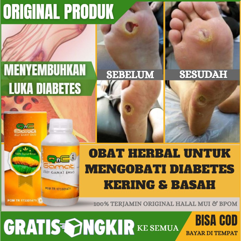 Obat Diabetes Kering, Salep Penghilang Luka Diabetes, Kencing Manis, Penghilang Luka Gangren - QNC