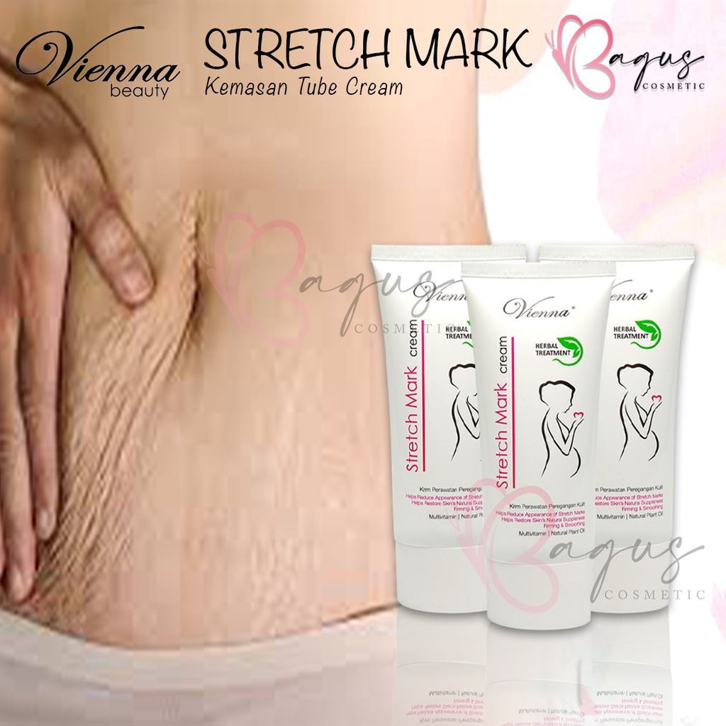 ⭐BAGUS⭐ (TUBE) VIENNA STRECH MARK CREAM BPOM / VIENNA SELULIT