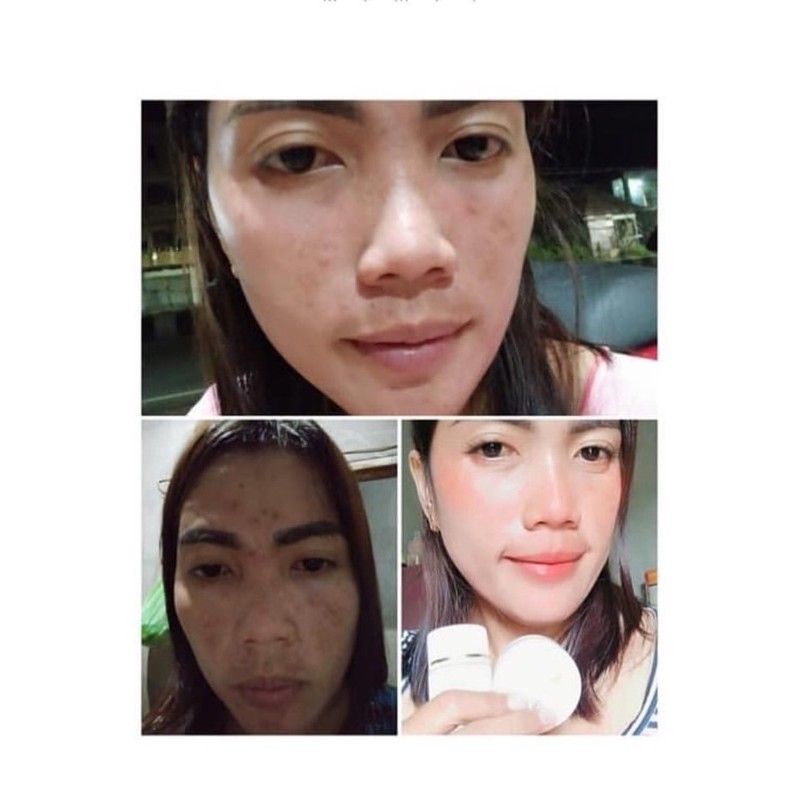 Image of MH skin whitening/member resmi/cream pemutih flek dan jerawat/bpom/cod #3