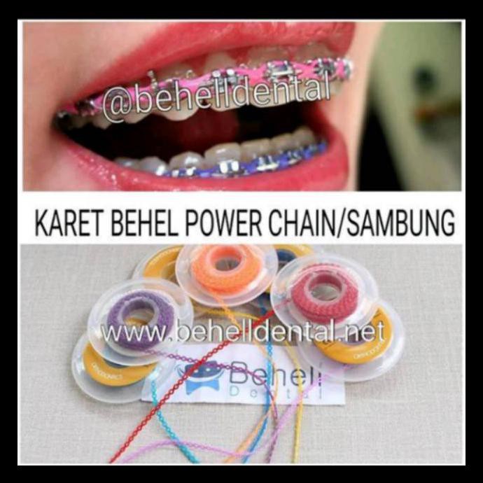 Warna Karet Behel Untuk Kulit Sawo Matang