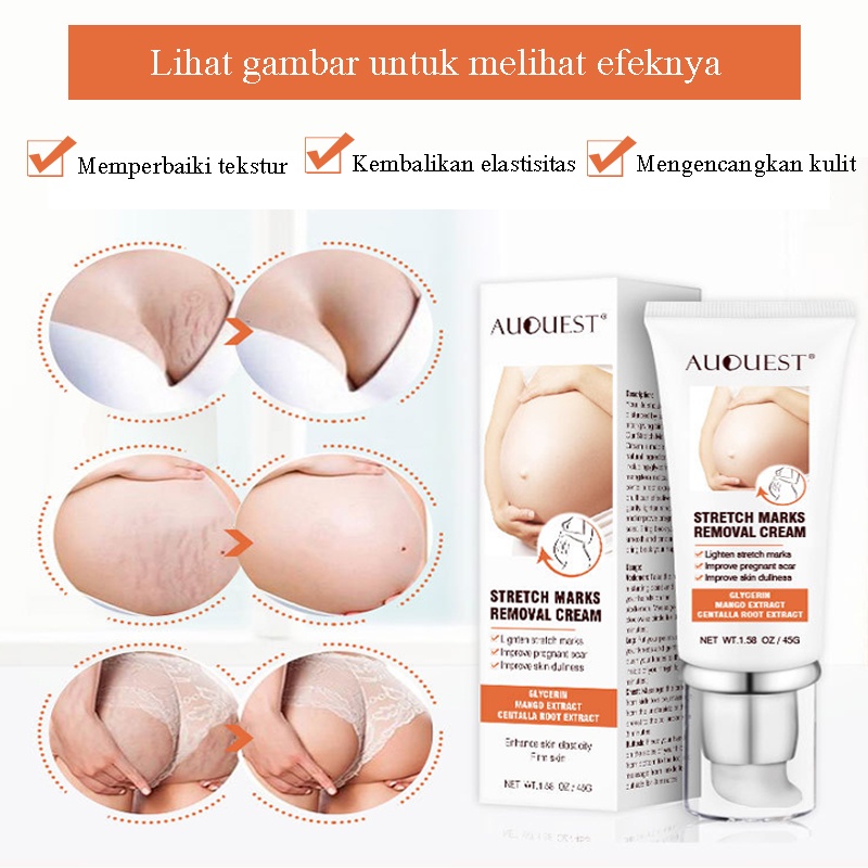 Stretch Mark Cream 45g / Penghilang Stretch Mark / Stretch Marks Pilihan Ibu / BPOM Penghilang Stretch Mark Ampuh / Mengencangkan kulit, mengembalikan kehalusan dan elastisitas