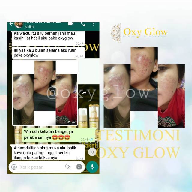 Paket Skincare Flek/Acne/Whitening OxyGlow Bonus Pouch Croco (Leather Bag)-4