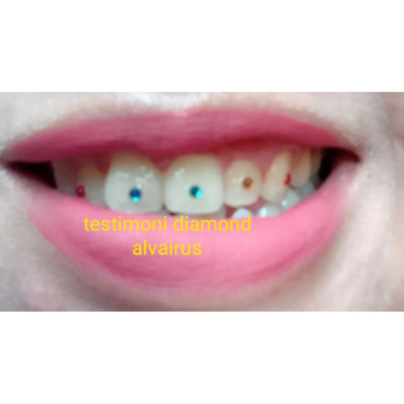 Diamond gigi / mutiara gigi