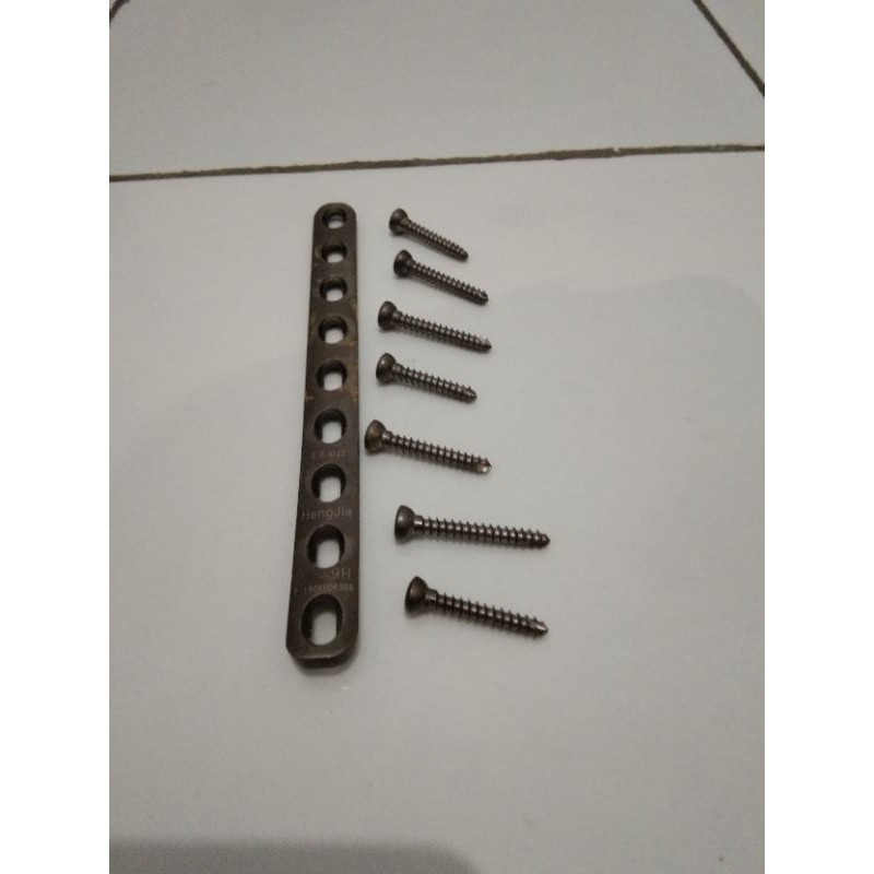 Pen Platina Patah Tulang Kaki