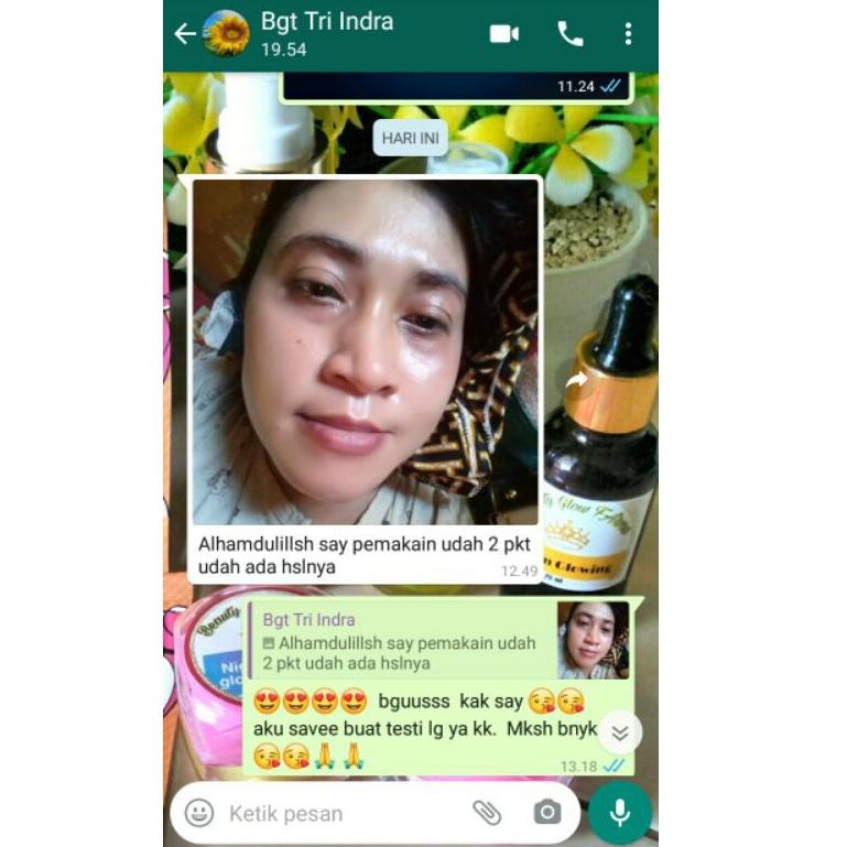 [KODE NB9DG] Paket Acne Glowing Beauty Glow Farma Ori Free Salep Jerawat & Pouch Cantik