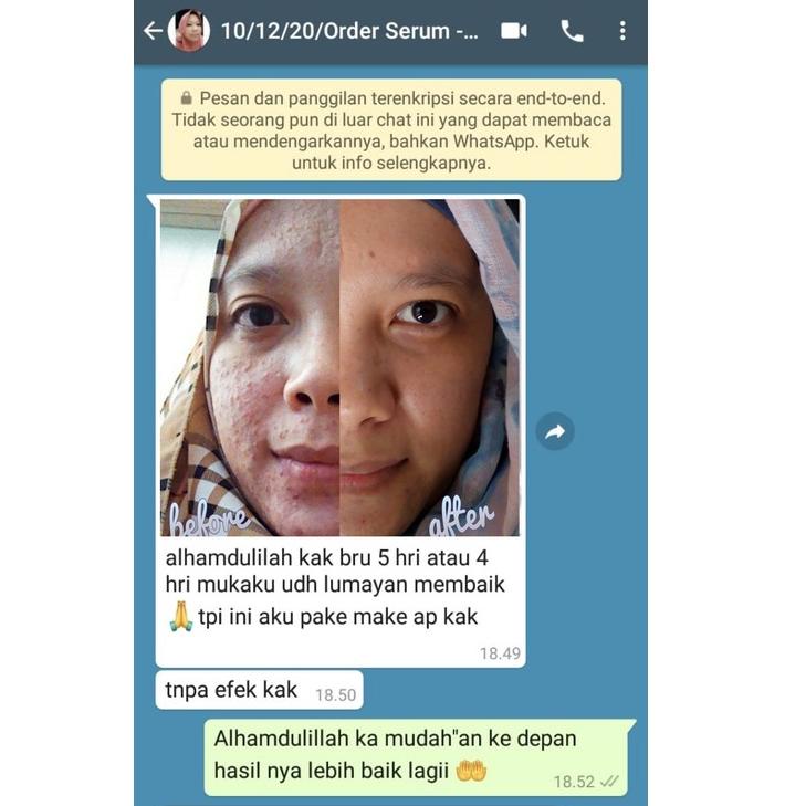 5J1 ADERA SERUM ORIGINAL FACE SERUM ADERA WAJAH ORI UNTUK FLEK HITAM GLOWING ORIGINAL BPOM ASLI 100%